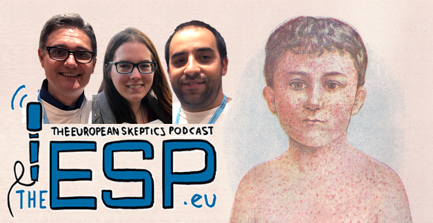 TheESP – Ep. #286 – What Happened to Measles?